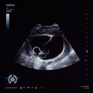 Vacra - En Attendant Paphos (Cover art)